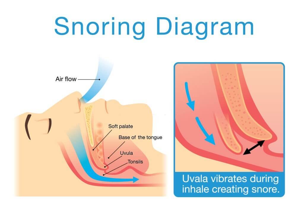 Anatomi saluran pernafasan saat tidur mendengkur.