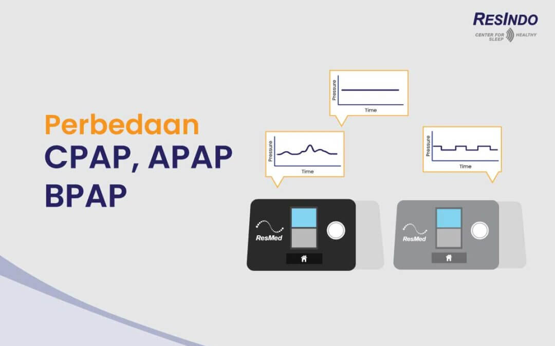 Perbedaan CPAP, APAP, dan BPAP yang Perlu Kamu Tahu